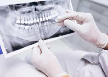 Как и сколько можно заработать на своем вырванном зубе